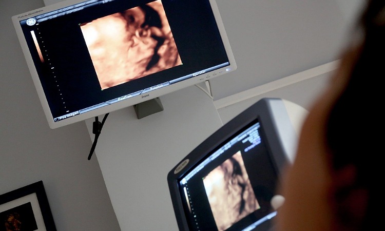 Equipo médico en Barranquilla logró operar con éxito a feto de 25 semanas