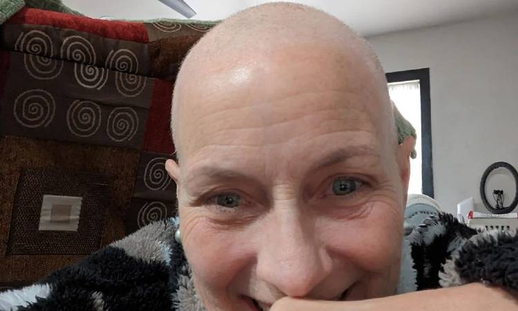 Kristina Lilley mostró, con orgullo, su calvicie en medio de su proceso con el cáncer
